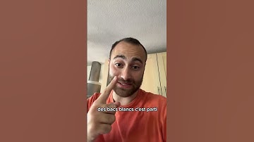 Challenging Bac Blanc Corrections #maths #prof #bac #lycee #spemaths