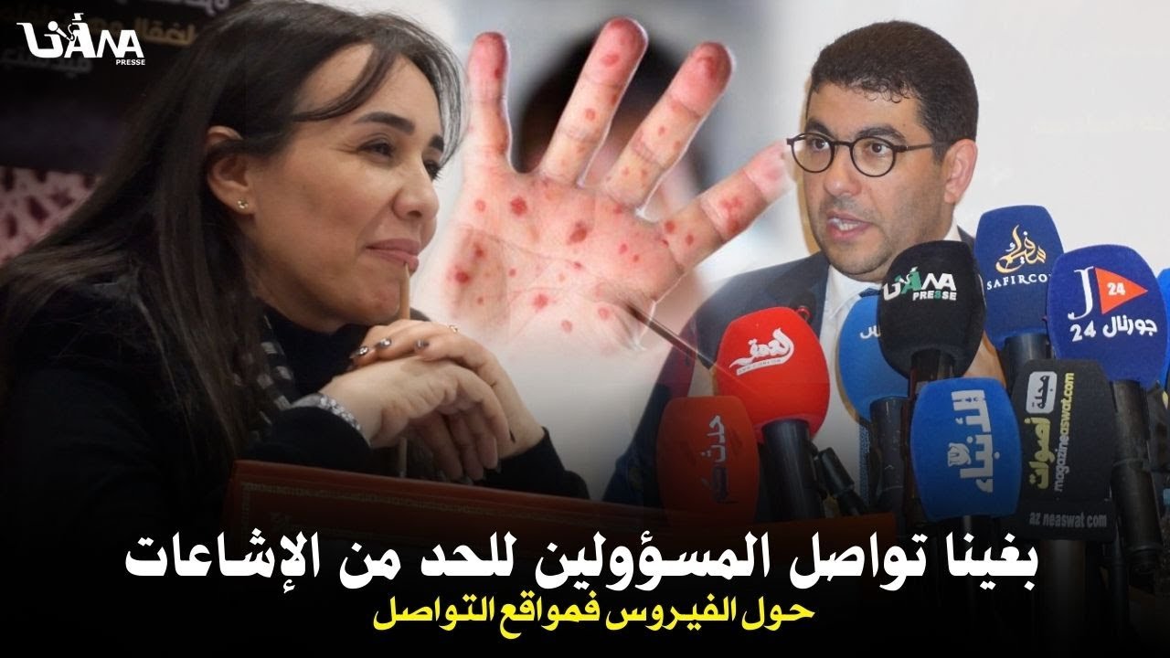 تدخل قوي للإعلامية سناء رحيمي مع وزير الثقافة بن سعيد حول تفشي بوحمرون وتواصل المسؤولين