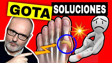 ¿Qué analgésico es bueno para la gota?