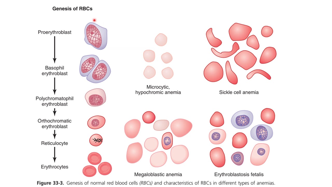 Анемия 2022. Вид эритроцитов при разных типах анемий. Red Blood Cells (RBCS. Дифферон клеток крови. Клетки голубой крови.