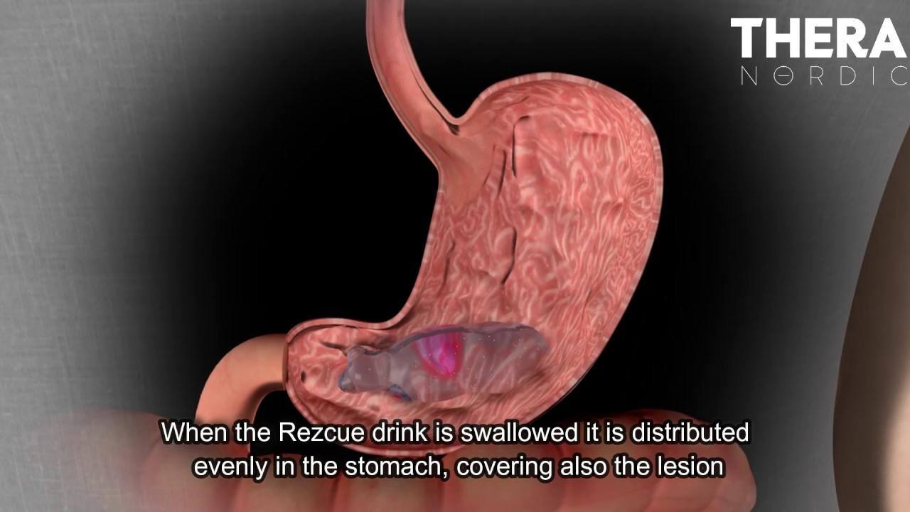 This is how Zinc Carnosine works! YouTube