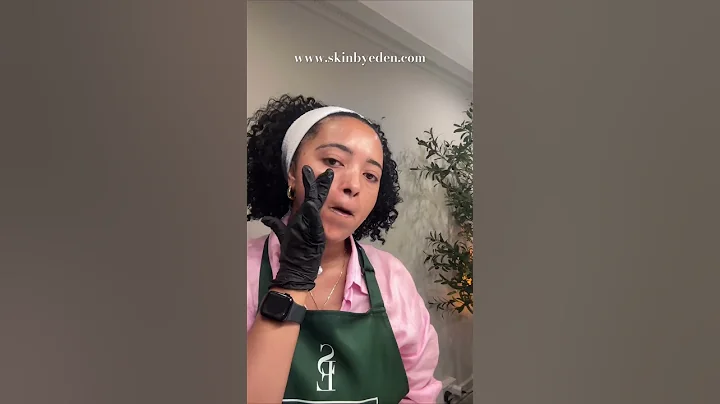 PRX-T33 Peel #prxpeel #prxt33  #chemicalpeel