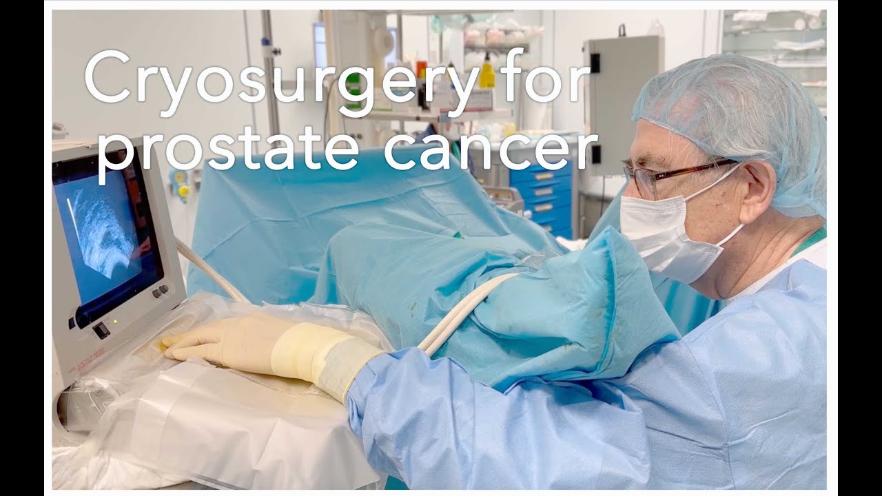 Cryosurgery for Prostate Cancer YouTube