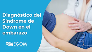 ¿Previenen las vitaminas prenatales el síndrome de Down?