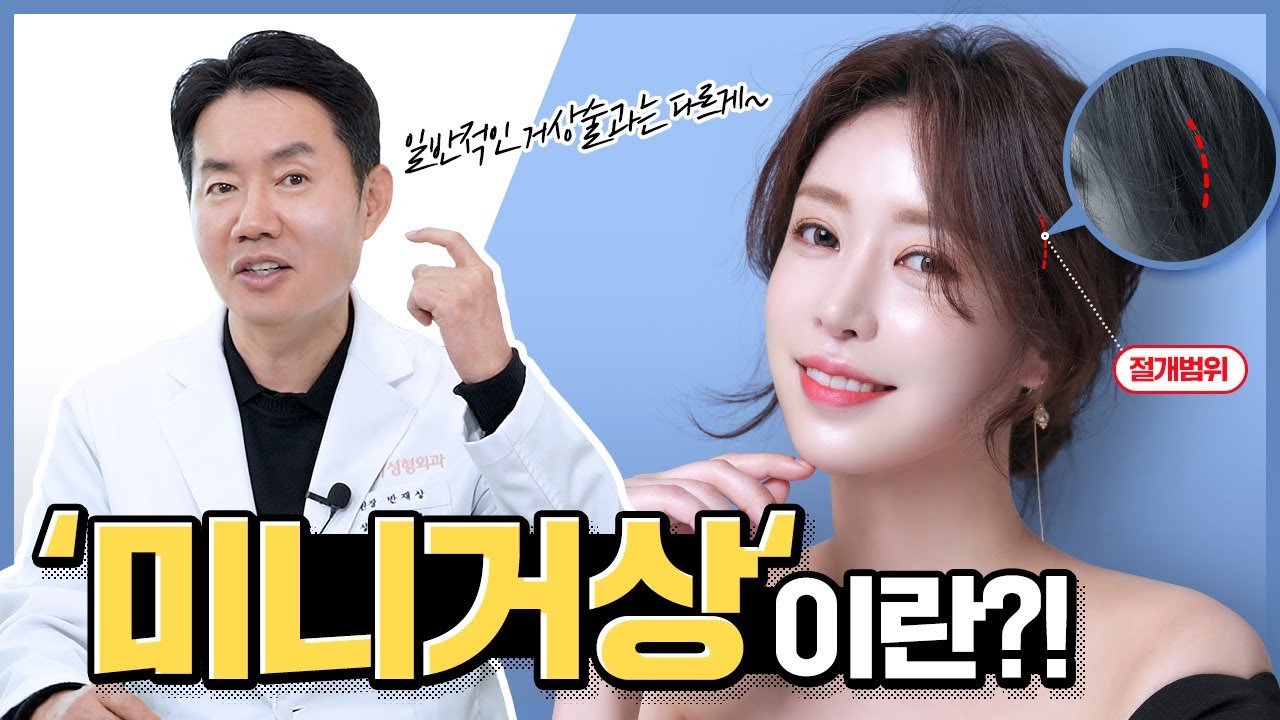 [동안성형] '미니거상'이란?