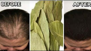 Japanese secret  to long hair at an imaginary speed and treatment of baldness