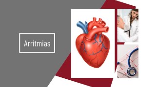 Arritmias