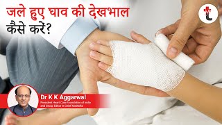 how to take care burn wound