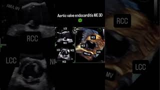 Imaging In In - The Me