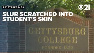 Racial slur scratched into student s skin 2 college swimmers suspended