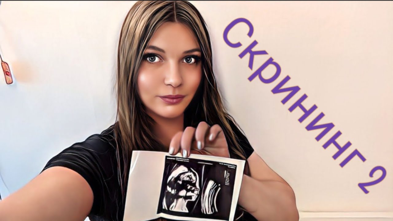 Второй скрининг #мама #беременность #скрининг #узи - YouTube