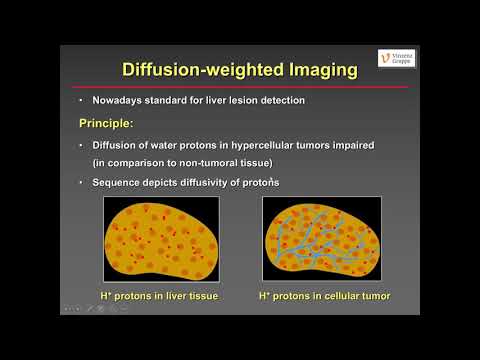 Liver metastases : what the radiologist needs to know, W Schima