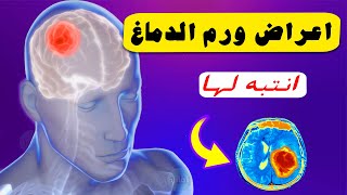 اعراض ورم الدماغ ، كيف تعرف إذا كان لديك ورم في الدماغ !