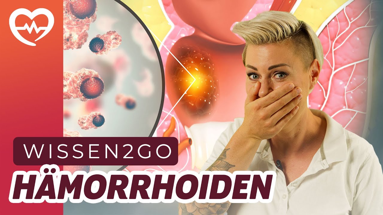 HÄMORRHOIDEN - WAS KANN MAN DAGEGEN TUN? I DOC CARO I - YouTube