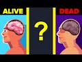 This is What Happens to Your Brain as You Are About to Die