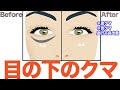 【目の下のクマ】黒グマ＆青グマを改善「眼輪筋＆眉毛下制筋＆鼻根筋リリース」血行改善エクササイズ【大分市 腰痛治療家 GENRYU ( 安部元隆 )】