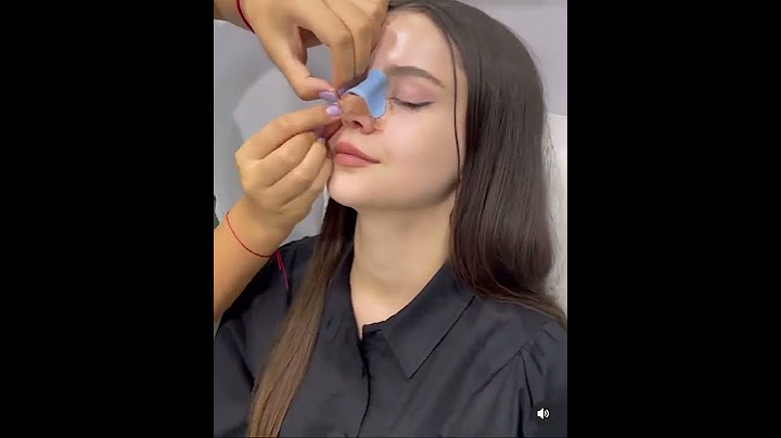 Rinoplastika əməliyyatdan sonra sarğı açılması ( Disney princess)
