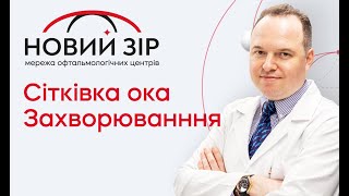 Лікування захворювання сітківки ока. Медикаментозні та лазерні методи лікування. Система Navilas