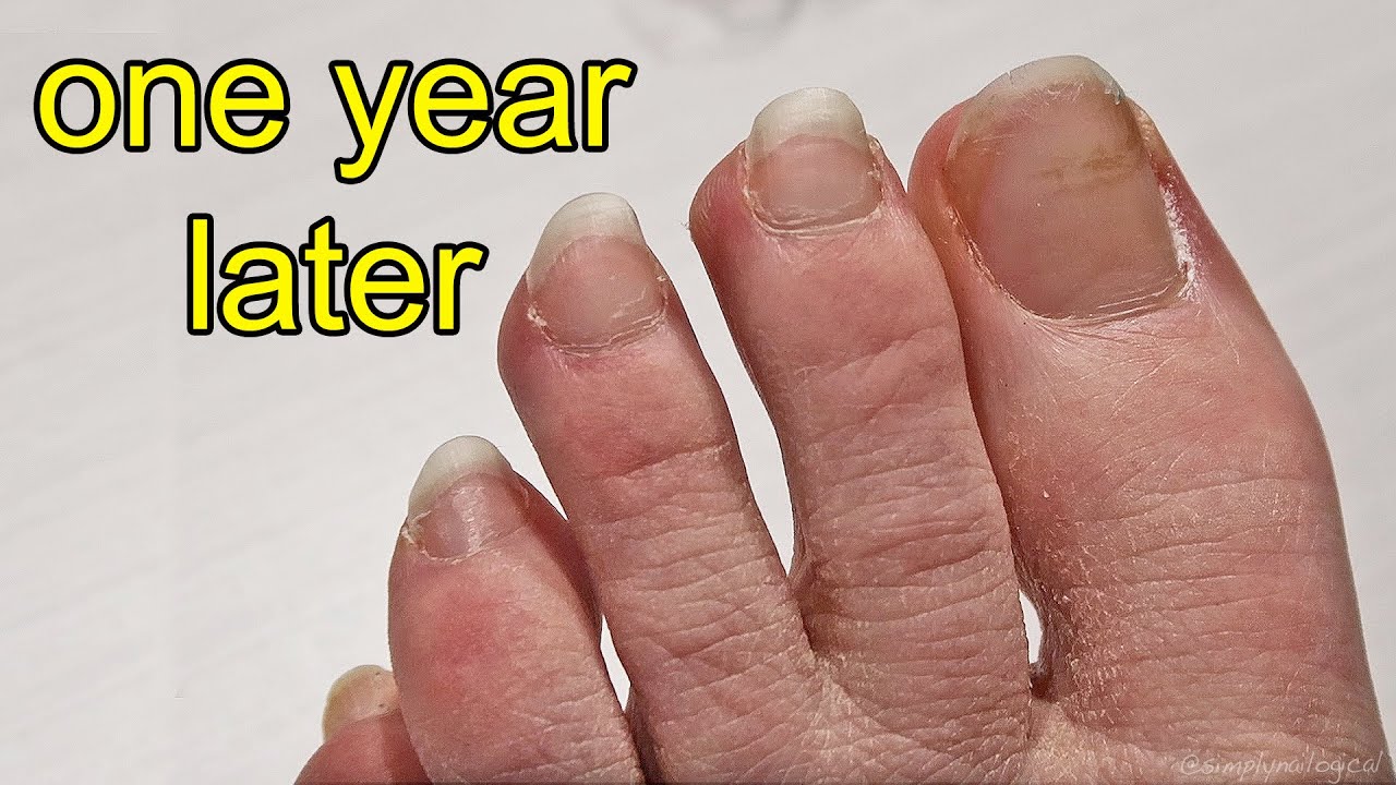 Repainting my Toe Nails After 1 Year of Growing Them Out