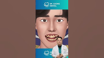 Răng khấp khểnh cần làm gì? | Bác sĩ Cường