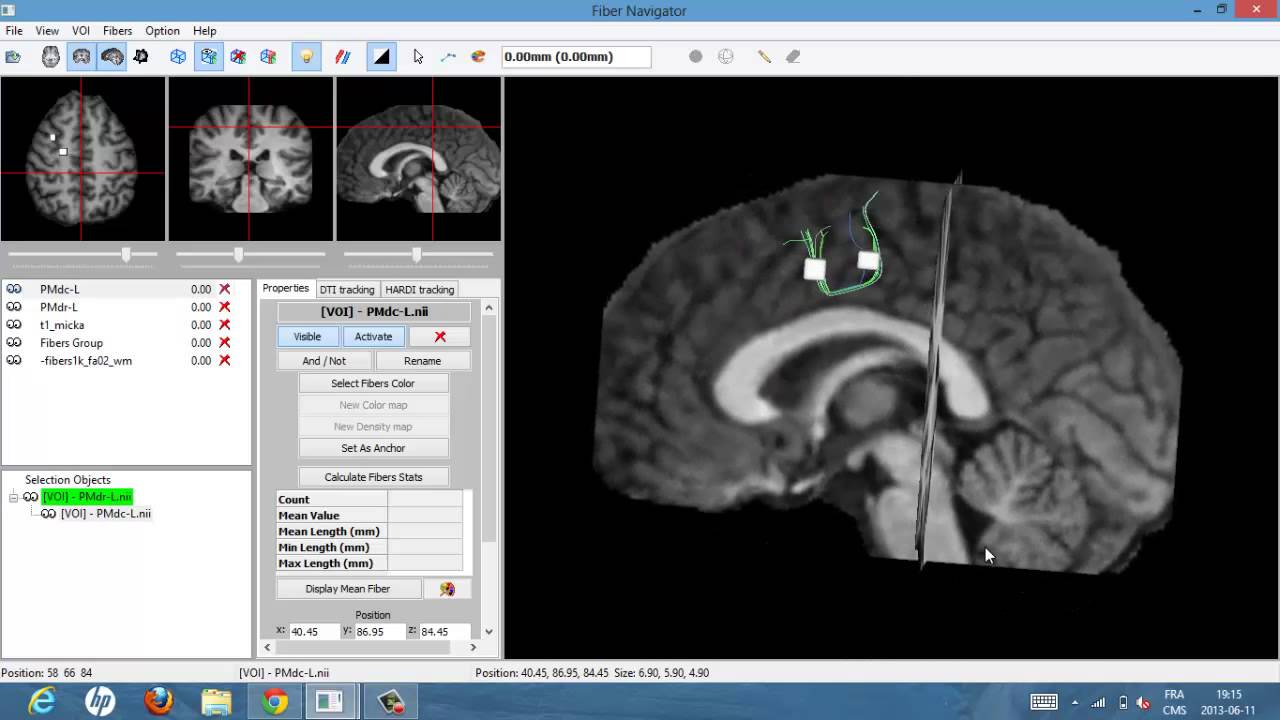 PMdc-PMdr-Left - YouTube