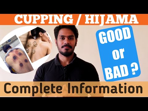 What is Cupping therapy in hindi | Hijama procedure | Benefits of cupping , side effects, procedure.