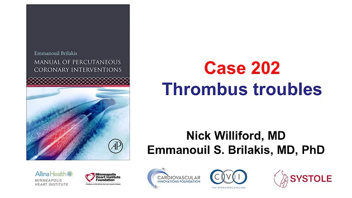 Case 202: Manual of PCI - Thrombus troubles