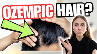 Ozempic & Hair Loss – What’s the Real Story?