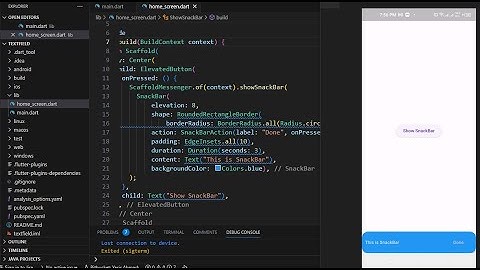 SnackBar Widget | How to add SnackBar | Flutter | Dart