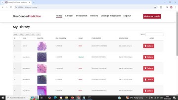 Oral Cancer Prediction Project using Deep Learning Python Django