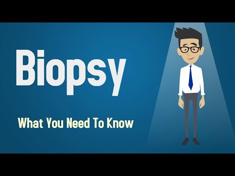 Biopsy - What You Need To Know