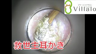 Download lagu 耳掃除 vol 67 救世主耳かき ear wax removal イヤーエステサロンVillalo ヴィラロ 耳掃除 vol 67 救世主耳かき ear wax removal イヤーエステサロンVillalo ヴィラロ
