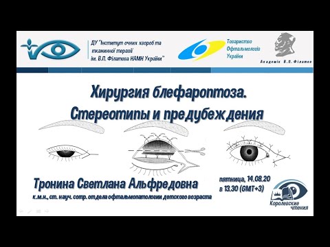 Хирургия блефароптоза. Стереотипы и предубеждения