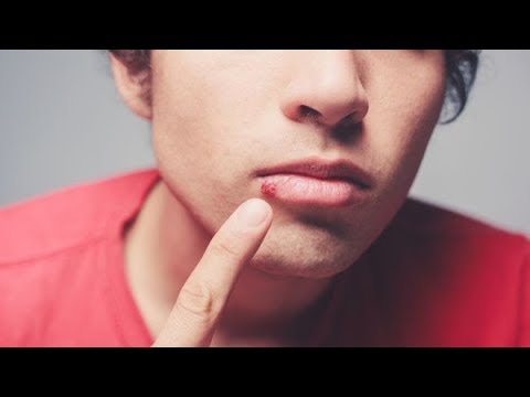 Video: A mund të përdorni bojë prekëse në buzë?