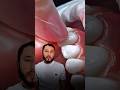 Виниры или коронки? Как не ошибиться с выбором! 🦷✨ | Советы стоматолога Muqarnas Clinic