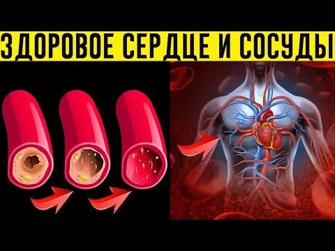 ЭТИ 10 Продуктов Чистят Сосуды и Снижают Риск Инфаркта!