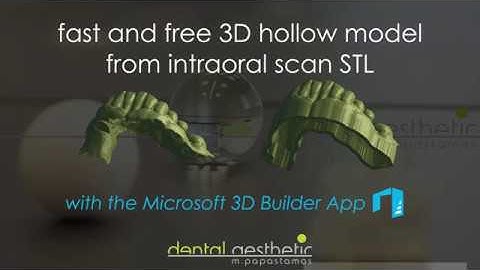 Free 3D hollow model from intraoral scan, using Microsoft 3D Builder App