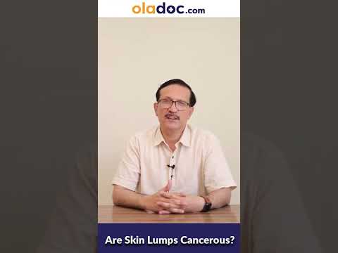Are All Lumps Cancerous - Kya Tamam Giltiyan Cancer Hoti Hain - How To Diagnose Cancer Lumps thumbnail image