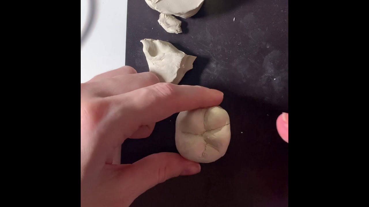 Первы моляр н/ч (2)