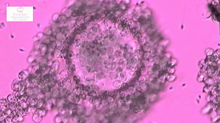 How are human embryos created in the laboratory? Call 214-618-2044