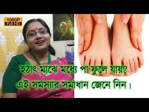 ভিডিও: ফোলা পা নিয়ে কীভাবে ঘুমাবেন?