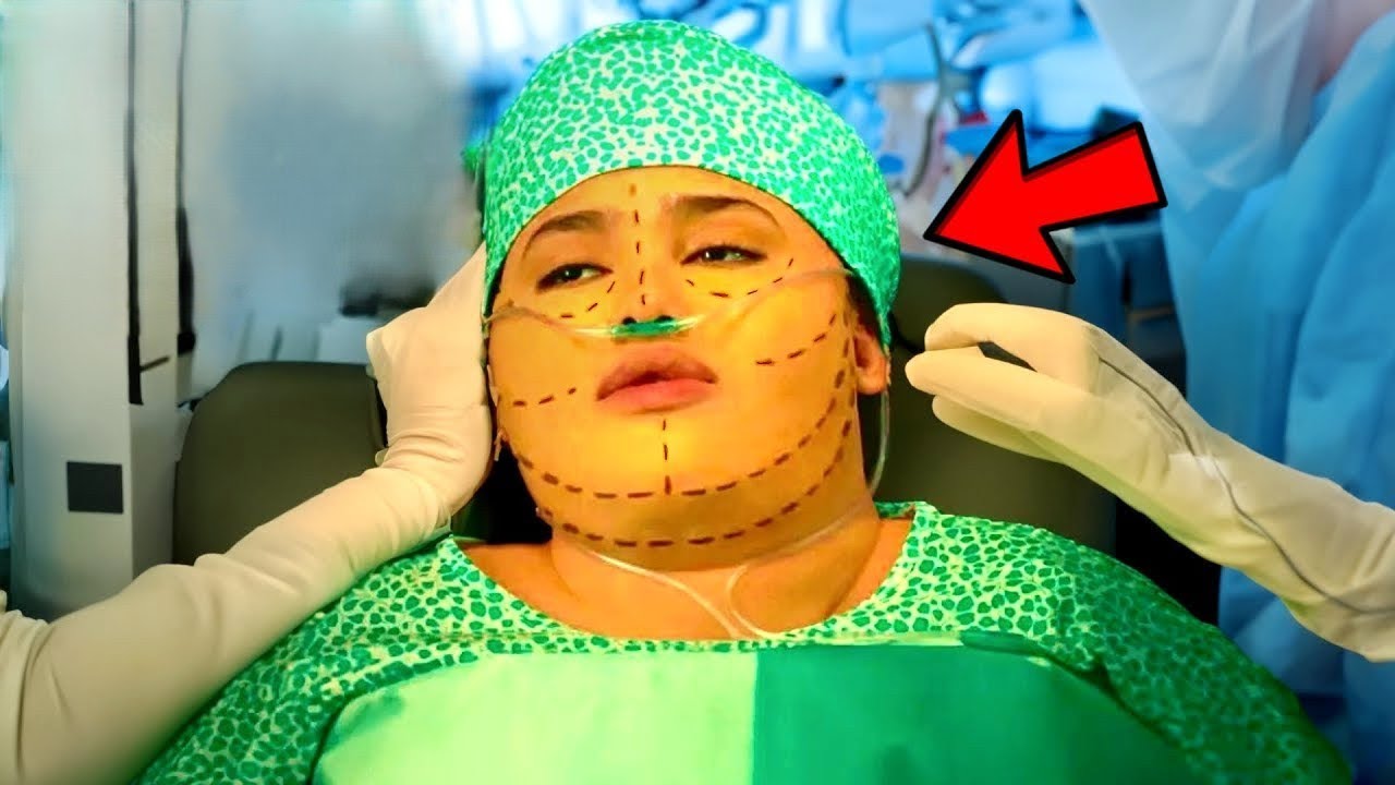 Zombaram Dela Por Causa Do Peso, Mas Ela Fez Cirurgia E Virou Uma Deusa