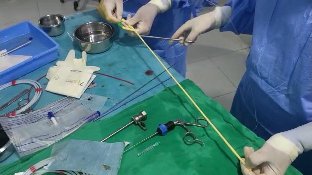 Mini PCNL Nephrostomy Stretched Latex Foley Catheter YouTube