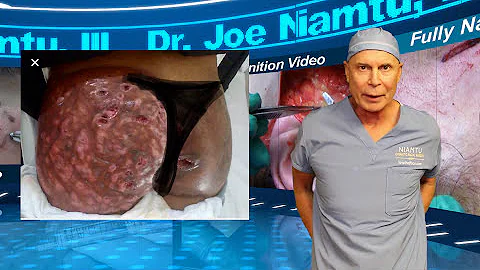 Beware of Biocollagen Injections by Non-Medical Personnel - DayDayNews