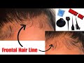How To: Bleach Knots On CLOSURE and FRONTAL | DEMONSTRATION |