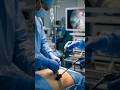 Operation Theatre Mein Bina Bade Cut Ke Surgery Kaise Hoti Hai? 😱 | Laparoscopic Surgery