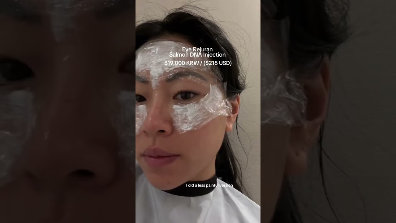 SKIN TREATMENTS I GOT IN KOREA 