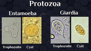 microscopical exam (Protozoal trophozoites & cysts)
