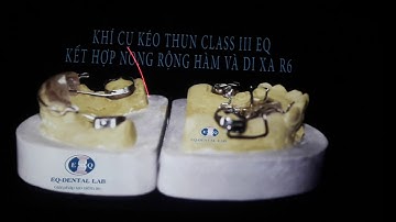 Khí cụ chỉnh nha phần 6 (cuối)