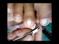 CLEANING DRY SKIN TOENAIL (repeat costumer)|Pedecure Vlog#57|@NailCare💅